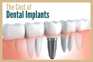 Illustration of a dental implant in cross-section with the words "The cost of dental implants"