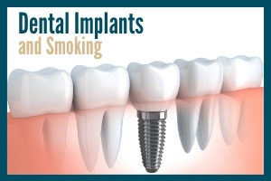 Illustration of dental implant and teeth in cross-section with the words "Dental Implants and Smoking"