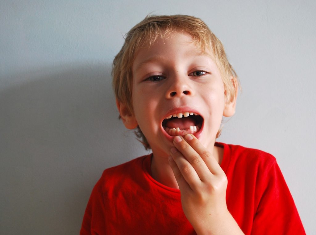 A young boy in red t-shirt showing that his two lower front teeth are missing
