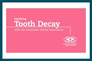 A screenshot of the Australian Dental Association video "Explaining Tooth Decay"